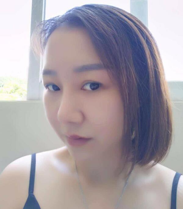 深圳蒳美迩医疗美容鼻部手术(耳软骨硅胶隆鼻)