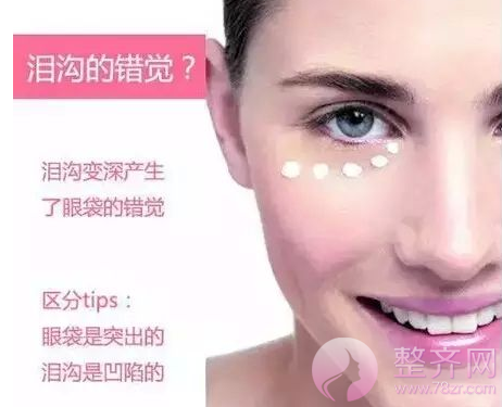 眼部有泪沟?用自体脂肪填后怎样才能保持久