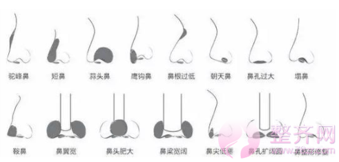 如何拥有一个精致的鼻子?