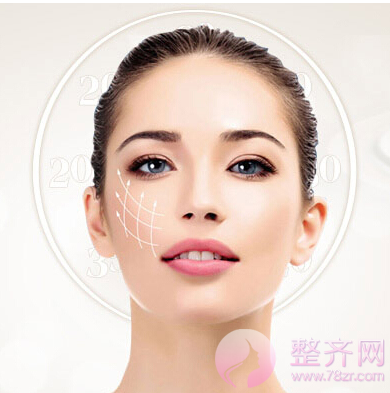 埋线提升的魅力,你到底了解多少?