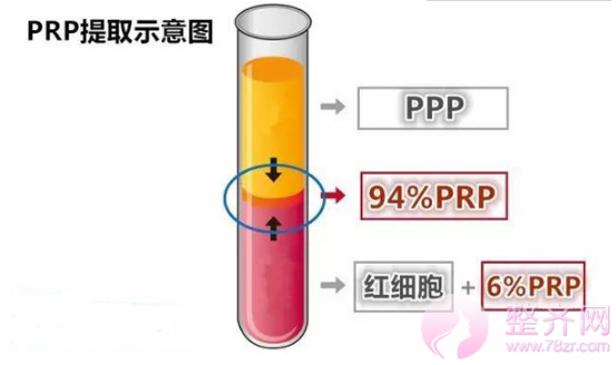 为什么需要做自体脂肪填充?