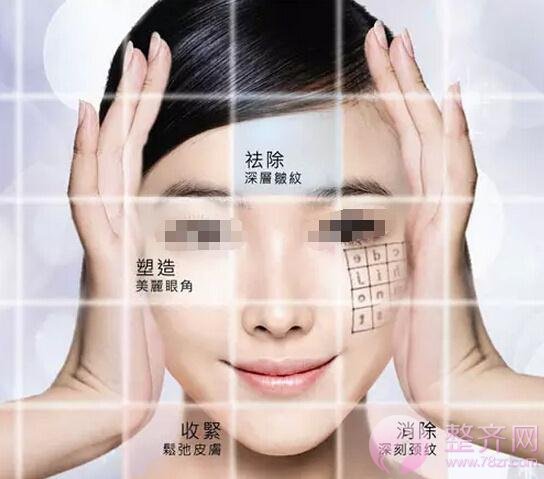 面部年轻化的3大绝招,你了解多少?