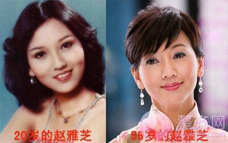 面部年轻化的3大绝招,你了解多少?