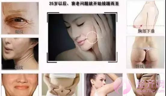 埋线提升提拉——提升、除皱、年轻化,抵抗地心引