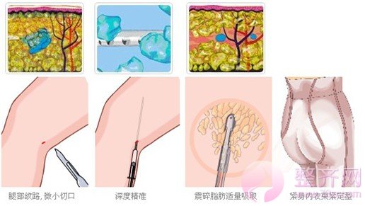今年瘦腿可以有,明年维密跟你走
