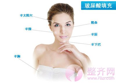 玻尿酸让你分分钟变美不是梦