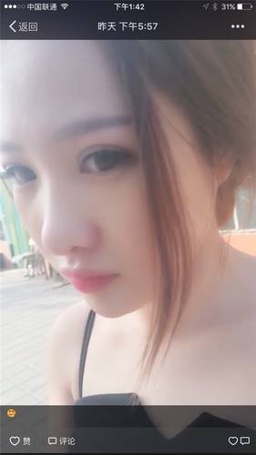 给姐妹们看看我的隆鼻案例,我的鼻子太漂亮,大家可不要羡慕我哦,哈哈哈哈,下面给大家看看我的变美经历!哇咔咔,嘿嘿~~~~