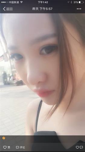 给姐妹们看看我的隆鼻案例,我的鼻子太漂亮,大家可不要羡慕我哦,哈哈哈哈,下面给大家看看我的变美经历!哇咔咔,嘿嘿~~~~