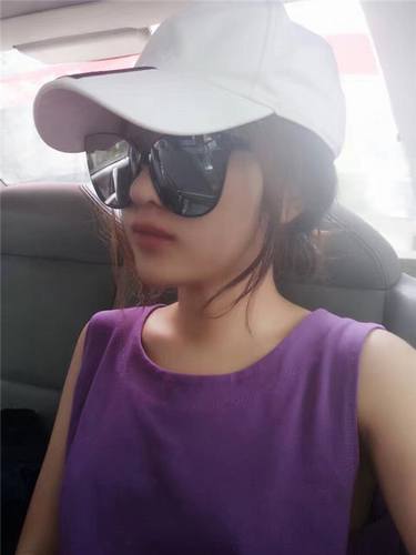 给姐妹们看看我的隆鼻案例,我的鼻子太漂亮,大家可不要羡慕我哦,哈哈哈哈,下面给大家看看我的变美经历!哇咔咔,嘿嘿~~~~