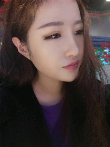 给姐妹们看看我的隆鼻案例,我的鼻子太漂亮,大家可不要羡慕我哦,哈哈哈哈,下面给大家看看我的变美经历!哇咔咔,嘿嘿~~~~