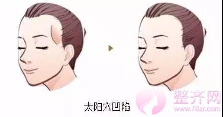 如何拥有美丽童颜