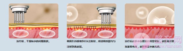关于水光补水,你不得不知道的八大真相!