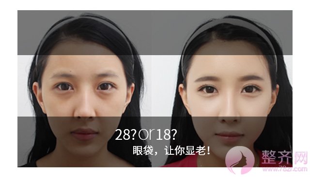 一个眼袋老十岁,你还把它挂脸上吗?
