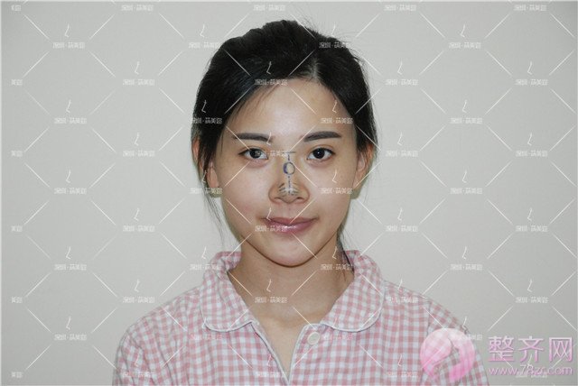 我的“香奈儿”韩式小翘鼻好看吗?get 到就炒鸡