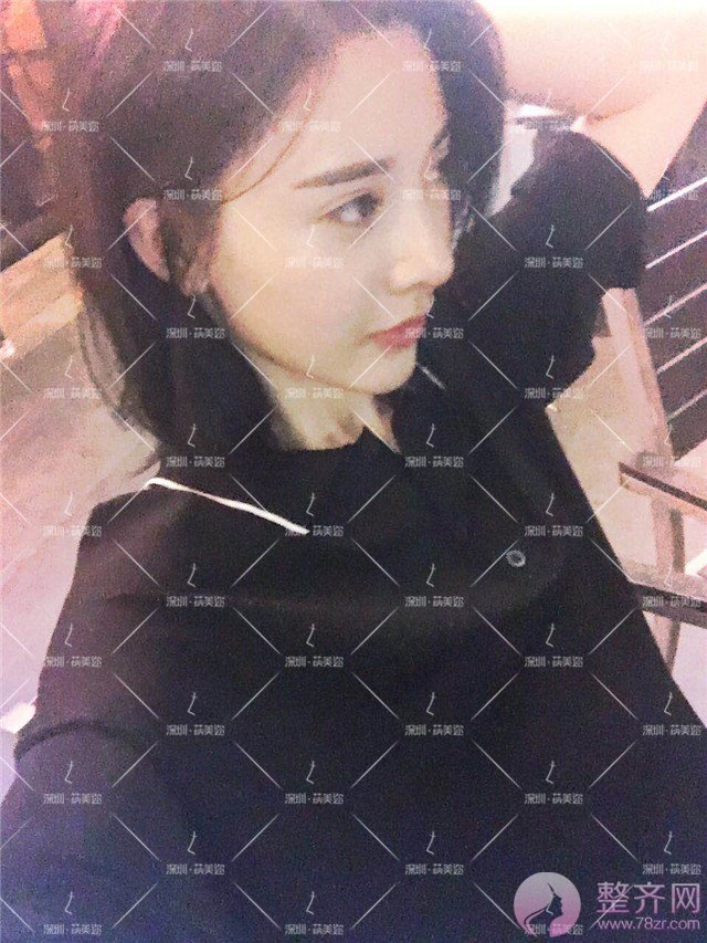 我的“香奈儿”韩式小翘鼻好看吗?get 到就炒鸡