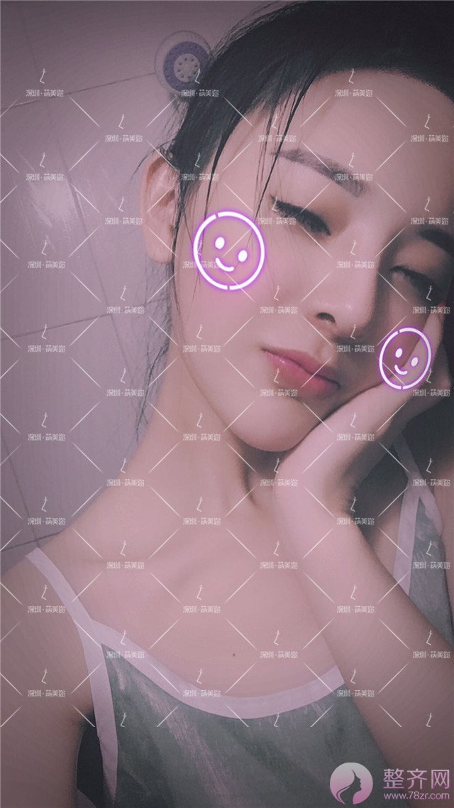 我的“香奈儿”韩式小翘鼻好看吗?get 到就炒鸡