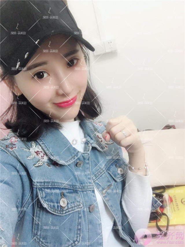 我的“香奈儿”韩式小翘鼻好看吗?get 到就炒鸡