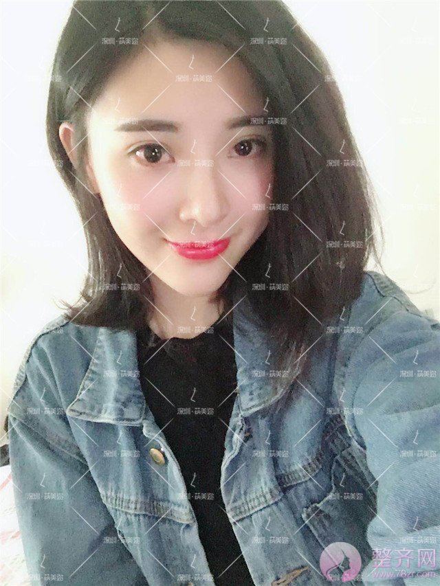 我的“香奈儿”韩式小翘鼻好看吗?get 到就炒鸡