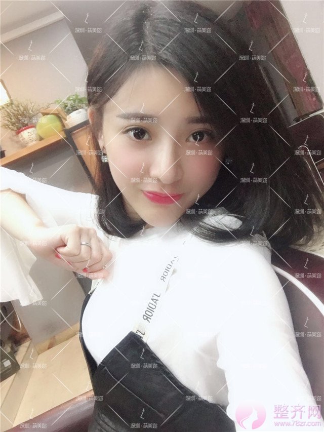 我的“香奈儿”韩式小翘鼻好看吗?get 到就炒鸡