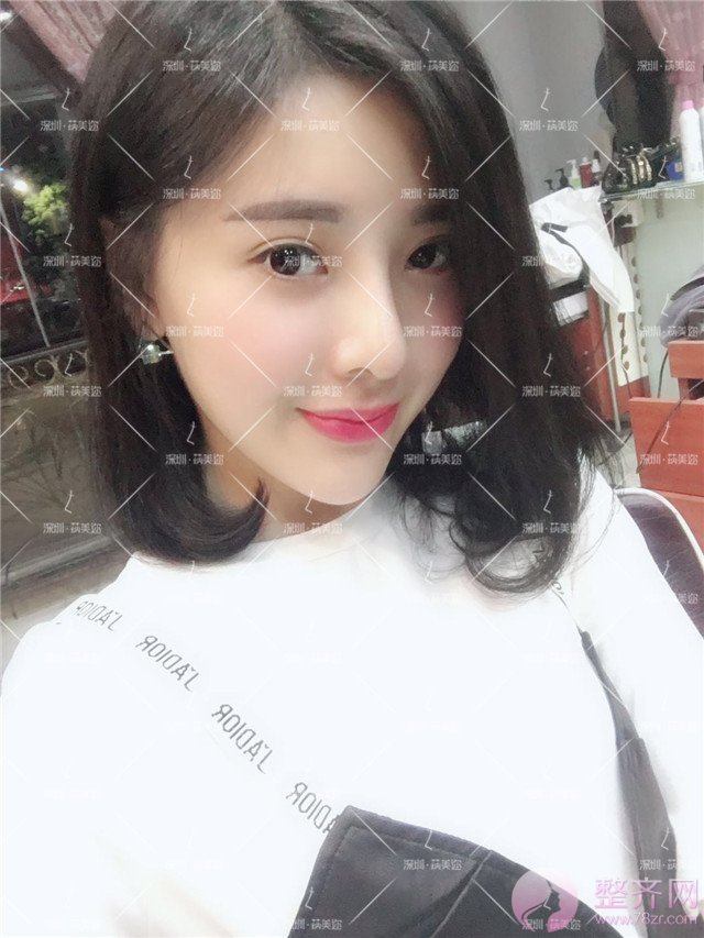我的“香奈儿”韩式小翘鼻好看吗?get 到就炒鸡