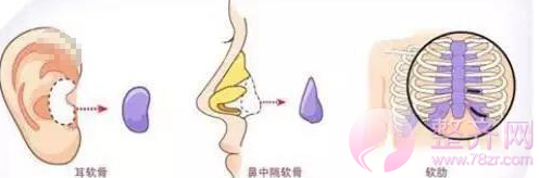 打注射瘦脸就能缩小鼻头?