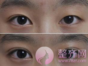什么样的眼睛较迷人?