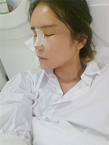 淘宝店主的变美经历,想要变美的看过来!! 隆鼻案例