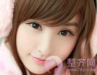 双眼皮修复的三要素