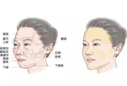 这4个部位凹陷,立马老10岁!