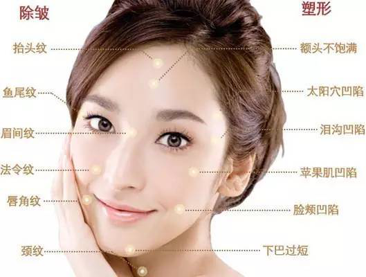 这4个部位凹陷,立马老10岁!