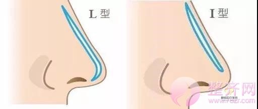 既然已经隆过鼻,为啥还要再做一次呢?