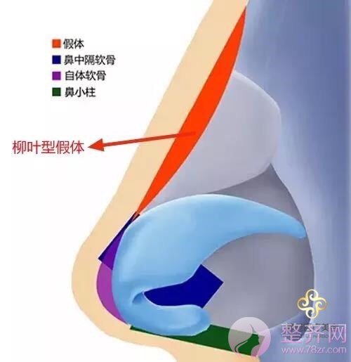 既然已经隆过鼻,为啥还要再做一次呢?