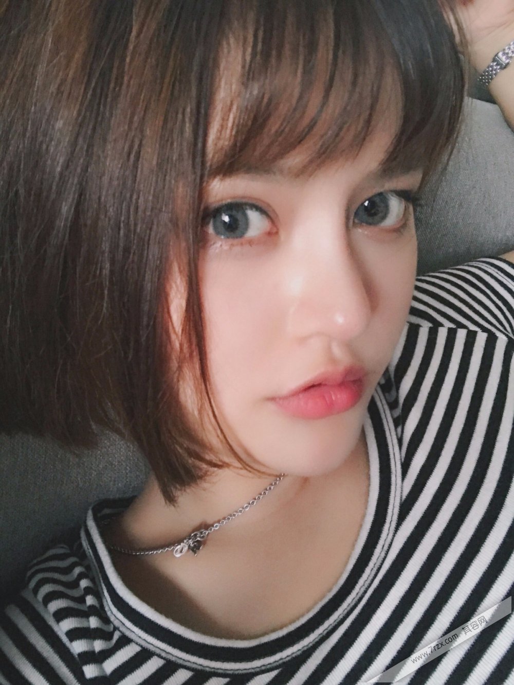 成都小姐姐的自体软骨隆鼻分享,打造欧美混血