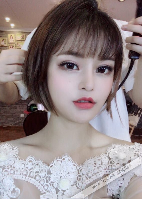 成都小姐姐的自体软骨隆鼻分享,打造欧美混血
