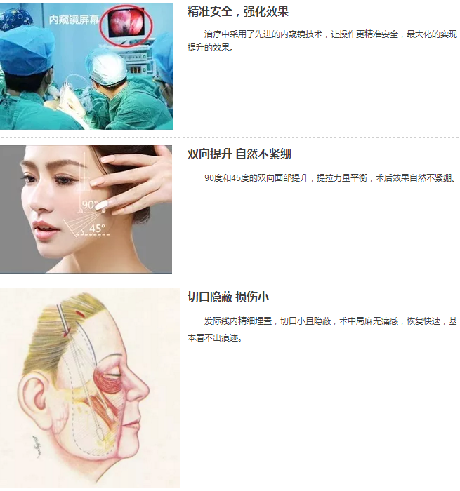 面部提升重返青春年华