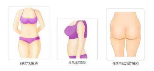 在脂肪填充的路上,你有没有辨识这几道坑?