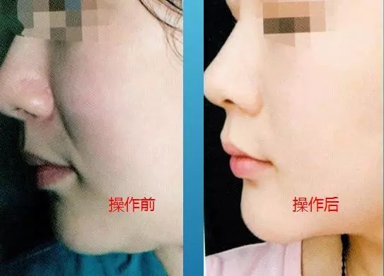 想要40岁依然保持年轻貌美吗?
