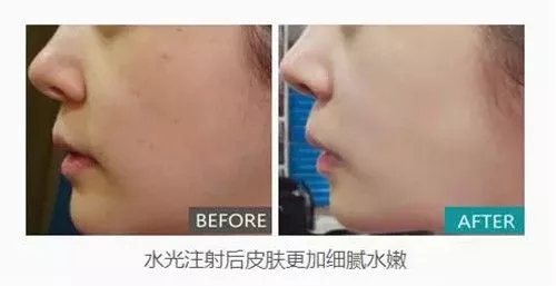 想要40岁依然保持年轻貌美吗?