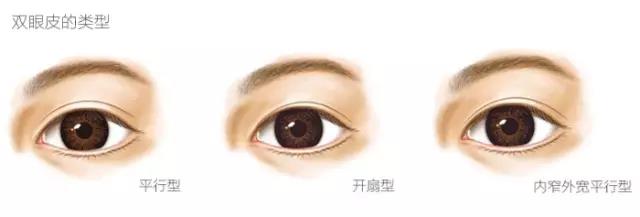 看完这个,终于知道为什么自己的双眼皮不好看