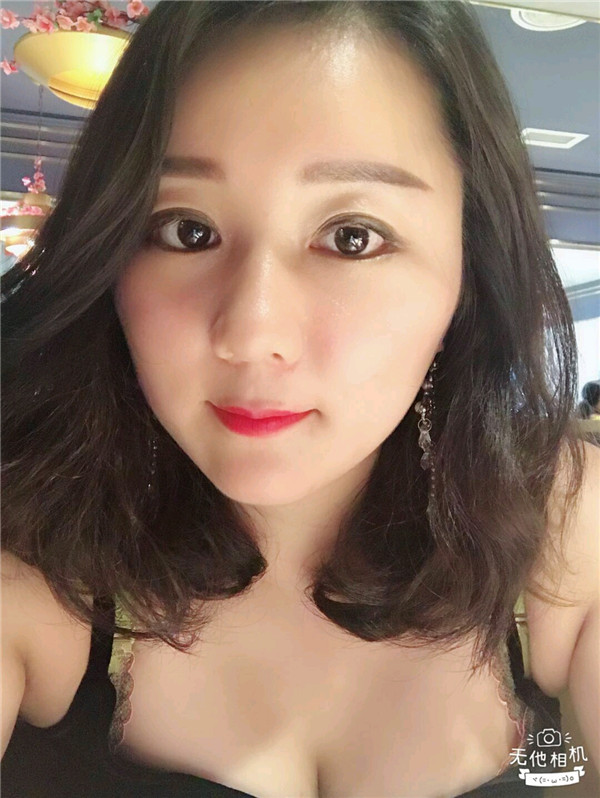 给姐妹们看看我的脂肪填充案例,做了脂肪填充脸部后大家都说我年轻了五岁,你们可不要羡慕我哦,哈哈哈哈,下面给大家看看我的变美经历!哇咔咔,嘿嘿~~~~