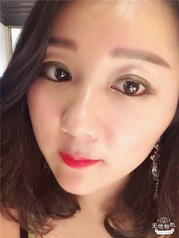 给姐妹们看看我的脂肪填充案例,做了脂肪填充脸部后大家都说我年轻了五岁,你们可不要羡慕我哦,哈哈哈哈,下面给大家看看我的变美经历!哇咔咔,嘿嘿~~~~