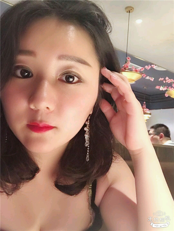 给姐妹们看看我的脂肪填充案例,做了脂肪填充脸部后大家都说我年轻了五岁,你们可不要羡慕我哦,哈哈哈哈,下面给大家看看我的变美经历!哇咔咔,嘿嘿~~~~