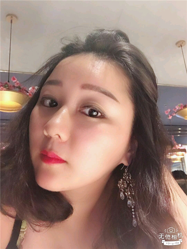 给姐妹们看看我的脂肪填充案例,做了脂肪填充脸部后大家都说我年轻了五岁,你们可不要羡慕我哦,哈哈哈哈,下面给大家看看我的变美经历!哇咔咔,嘿嘿~~~~