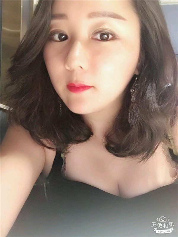 给姐妹们看看我的脂肪填充案例,做了脂肪填充脸部后大家都说我年轻了五岁,你们可不要羡慕我哦,哈哈哈哈,下面给大家看看我的变美经历!哇咔咔,嘿嘿~~~~