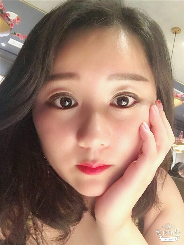 给姐妹们看看我的脂肪填充案例,做了脂肪填充脸部后大家都说我年轻了五岁,你们可不要羡慕我哦,哈哈哈哈,下面给大家看看我的变美经历!哇咔咔,嘿嘿~~~~