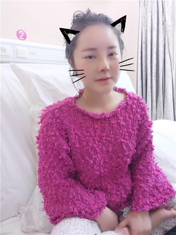 可爱的小仙女们,自从做了鼻部手术后,我觉得我在往网红的道路上越走越远了哈哈哈~~每天都是自拍自拍,进来看看我的美图案例吧!