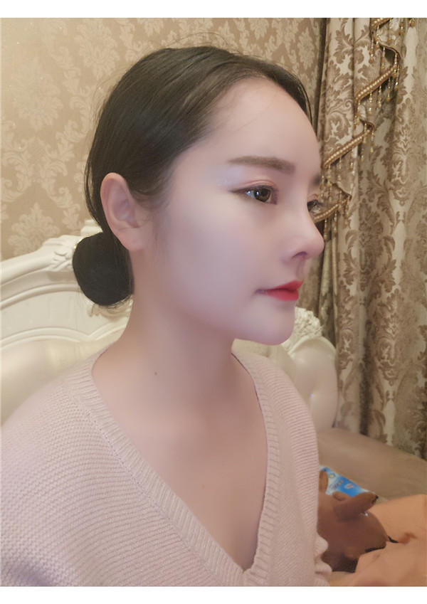 可爱的小仙女们,自从做了鼻部手术后,我觉得我在往网红的道路上越走越远了哈哈哈~~每天都是自拍自拍,进来看看我的美图案例吧!