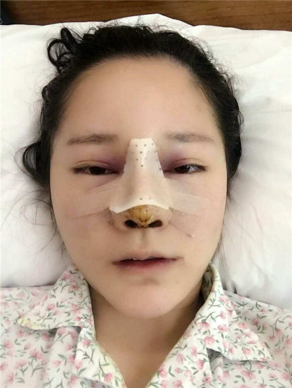 可爱的小仙女们,自从做了鼻部手术后,我觉得我在往网红的道路上越走越远了哈哈哈~~每天都是自拍自拍,进来看看我的美图案例吧!