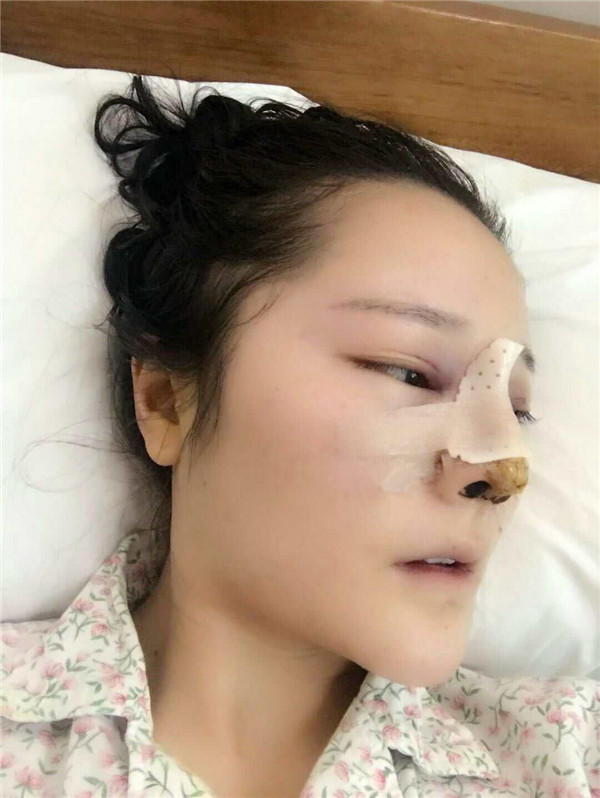 可爱的小仙女们,自从做了鼻部手术后,我觉得我在往网红的道路上越走越远了哈哈哈~~每天都是自拍自拍,进来看看我的美图案例吧!
