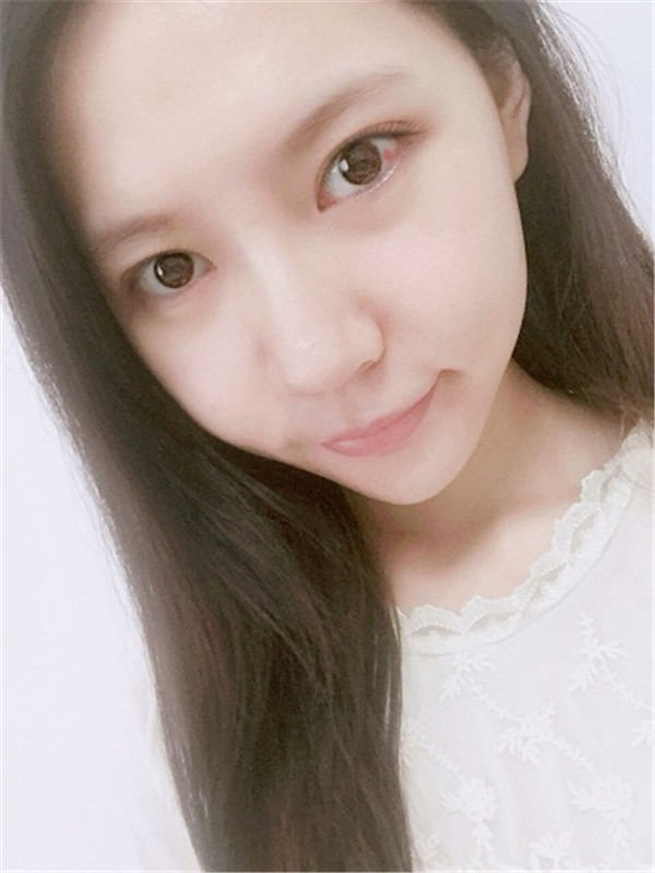 我的长曲线改脸型变V脸女神案例!!姐妹们,我之前的脸很长给人怪怪的感觉,现在也是一名小脸女神哈哈哈~~~